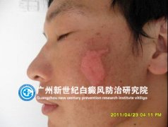 ������ 27�� �����װ߰���� 