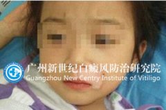 ��С���� 8�� �촽�Ƕ�֮�䲿λ�װ�1��� 