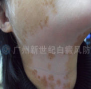 ��Ůʿ 25�� �����װ�10���� 