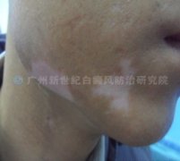 ������ 25�� �����������װ�10���� 