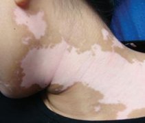 ������ƾ������磿 