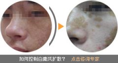 �����ϰ���Ӱ������������ 