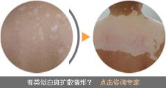 ��ȫ�Ͱ��綼����Щ�ص�? 